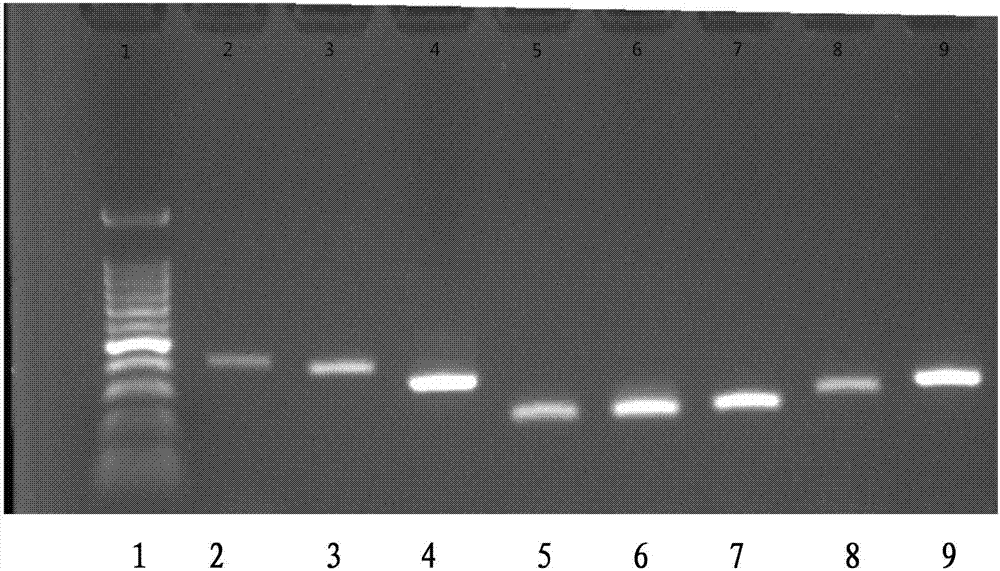 Primer combination for detecting PCR of Elizabethkingia meningoseptica
