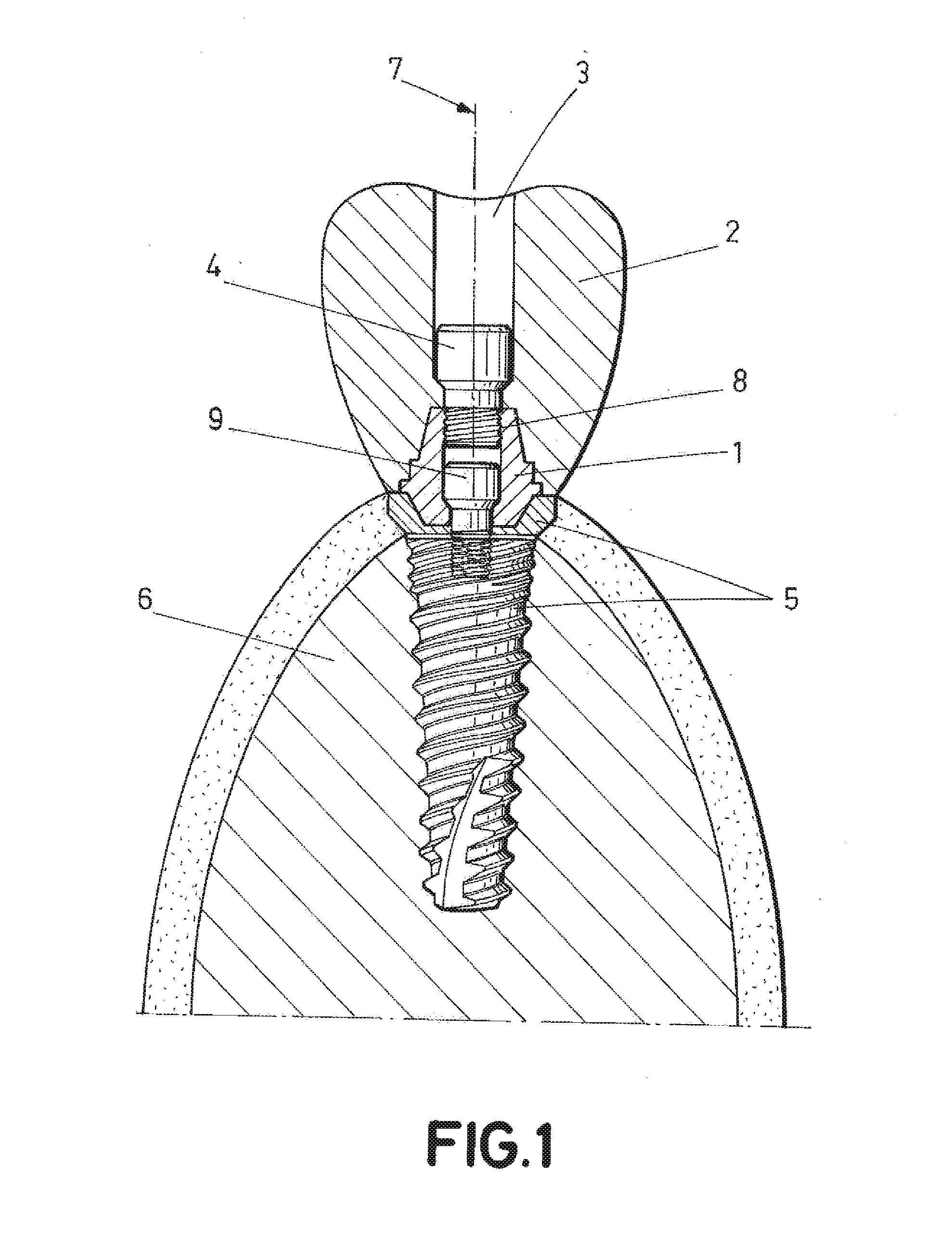 Dental post for supporting dental prostheses and method for the production thereof