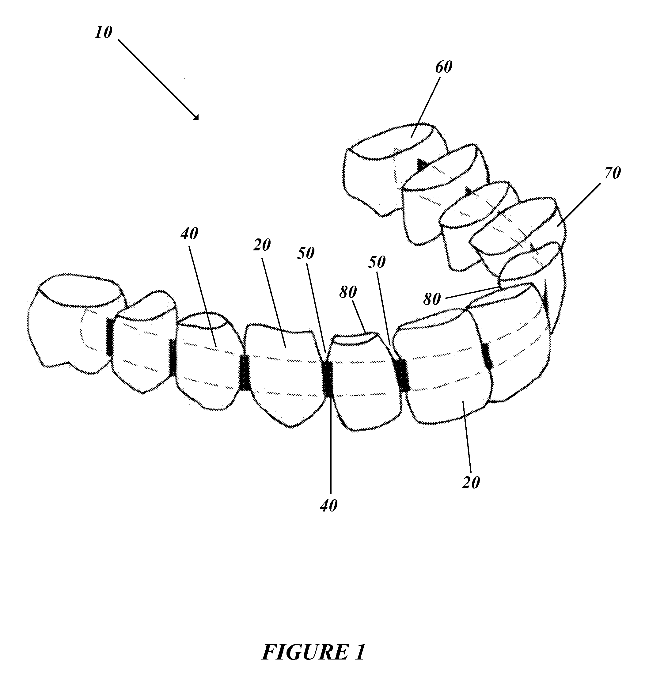 Teeth indexing device
