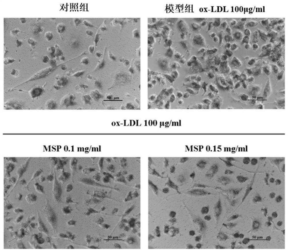 Application of millet bran active polyphenol in preparation of product for preventing and treating atherosclerosis