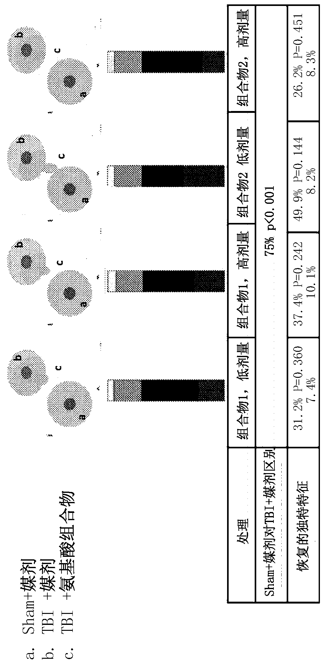 Branched-chain amino acids for the treatment of neuronal injury