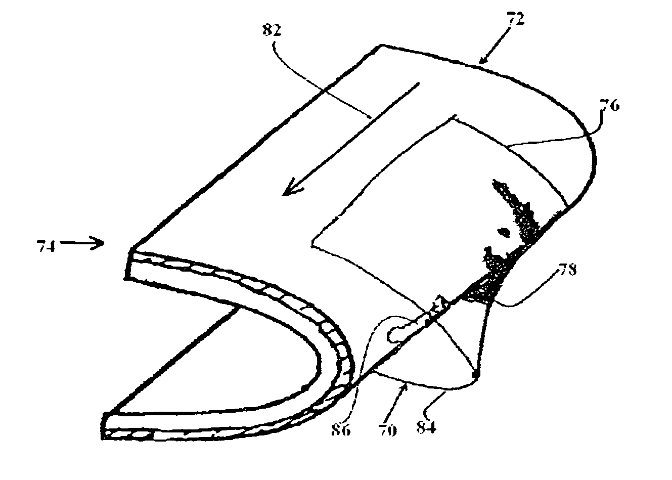 Method of repairing an airfoil surface