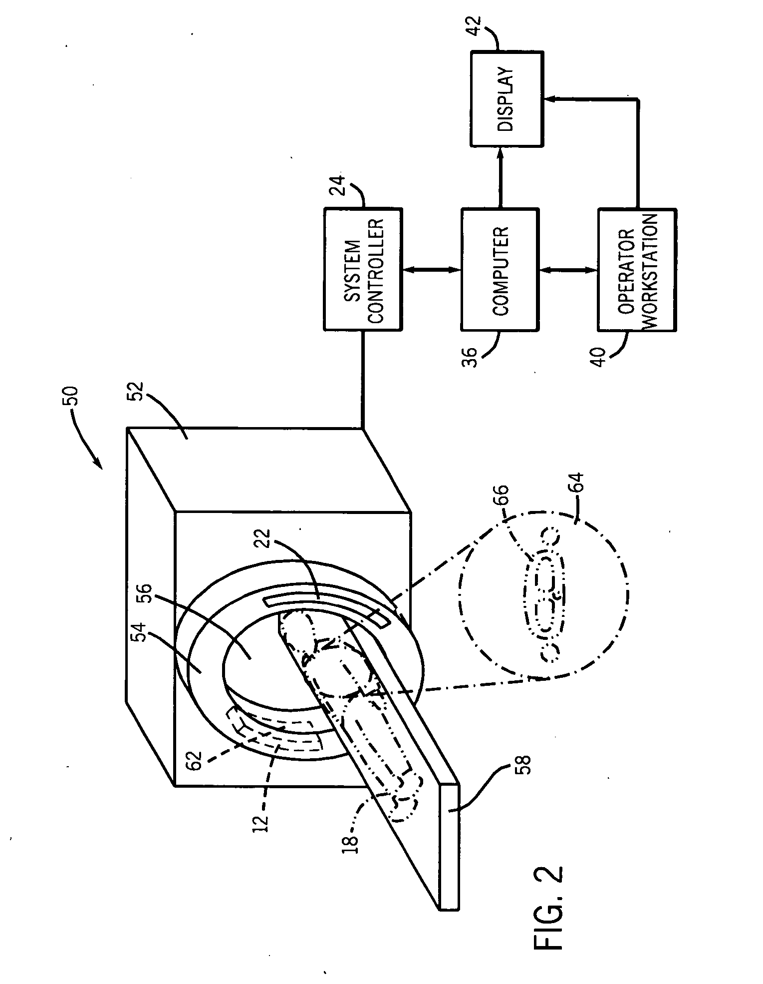Method and apparatus for segmenting structure in CT angiography