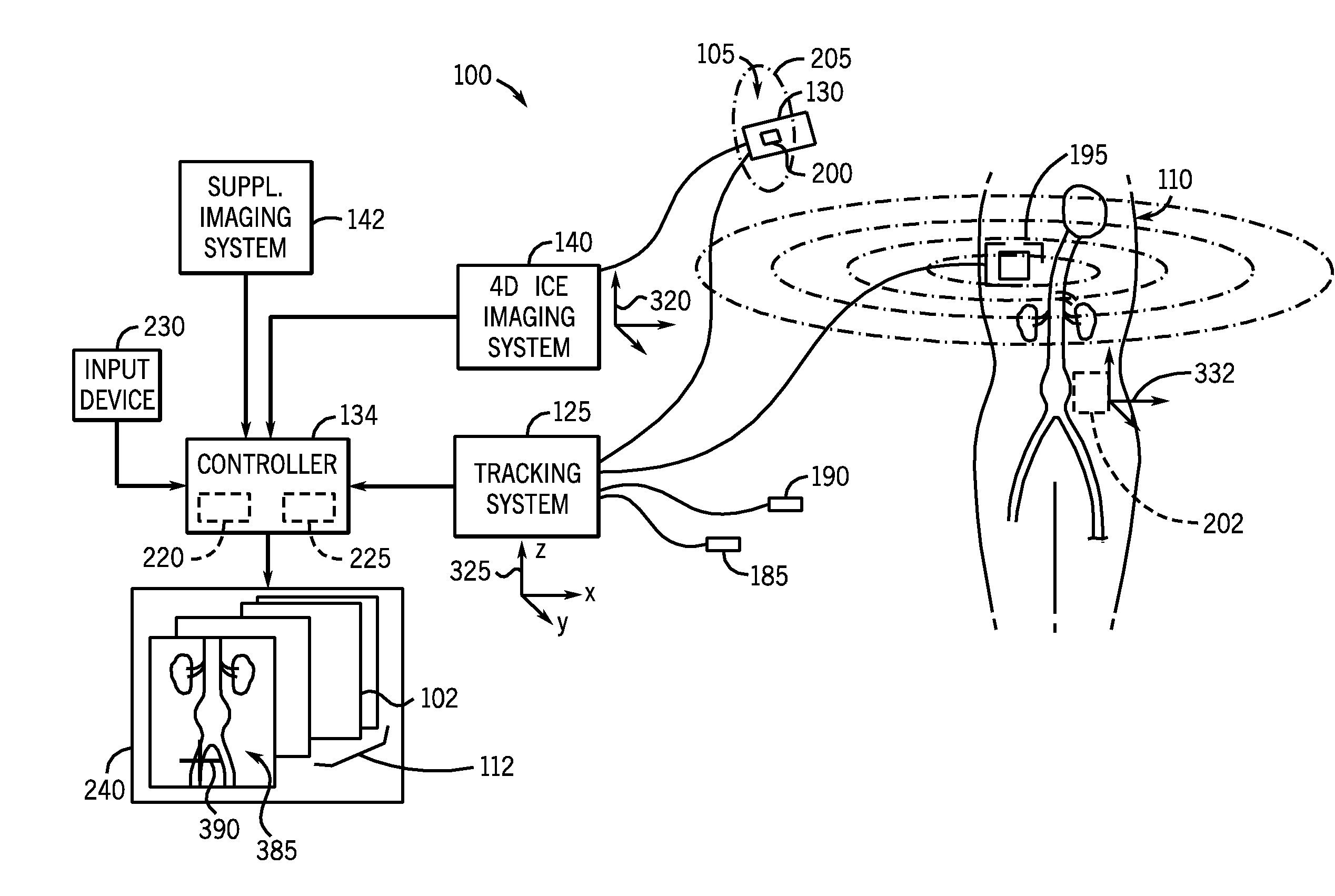 System and method of extended field of view image acquisition of an imaged subject