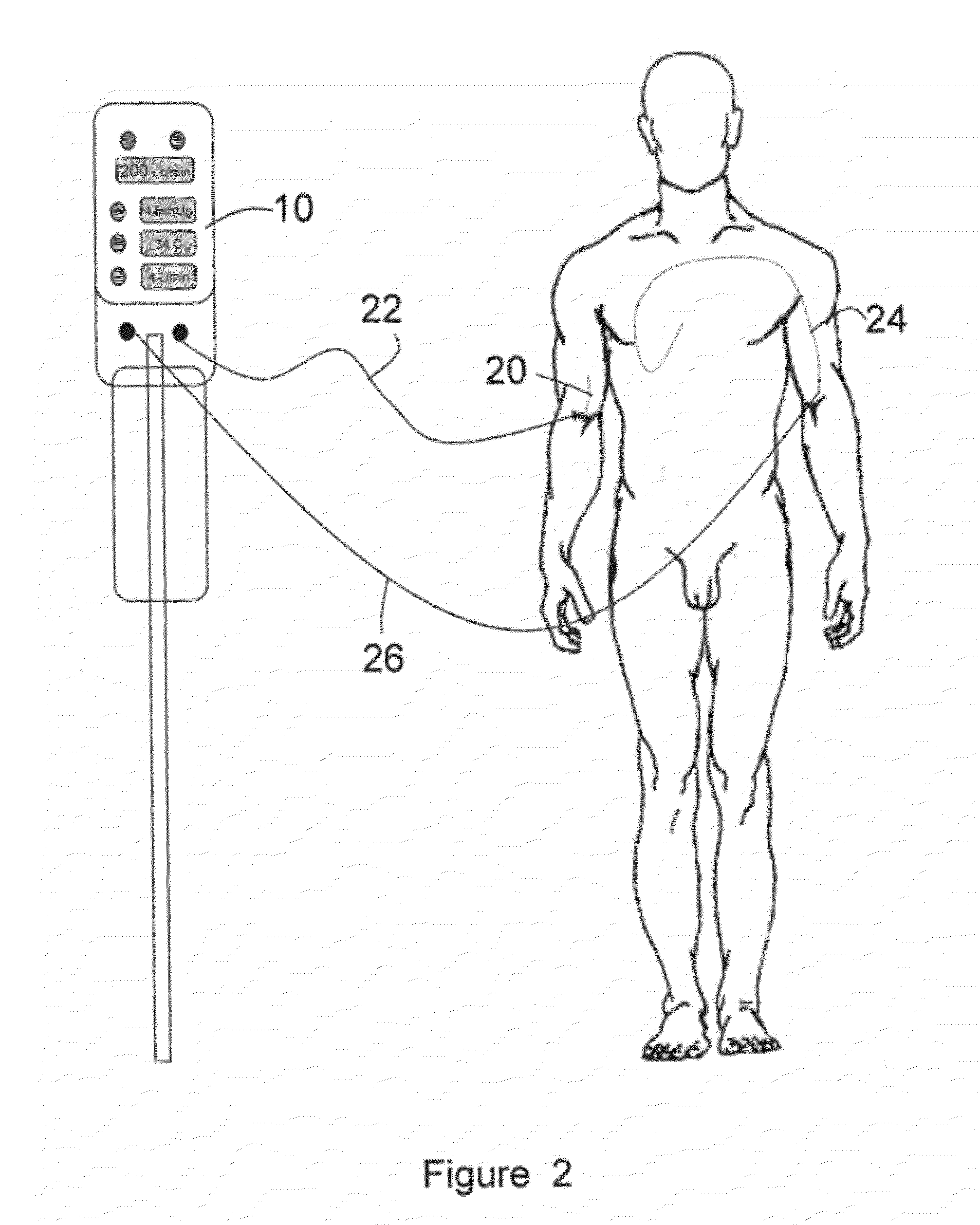 Automated Therapy System and Method