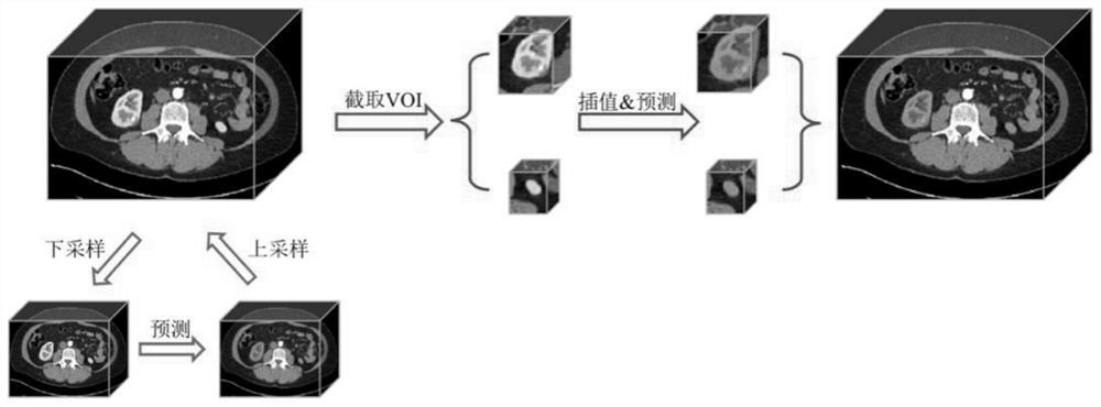 Image segmentation method for kidney tumor