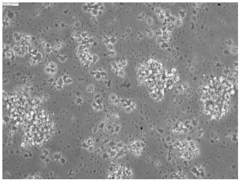 Culture medium and its application in the culture of central memory T-lymphocytes