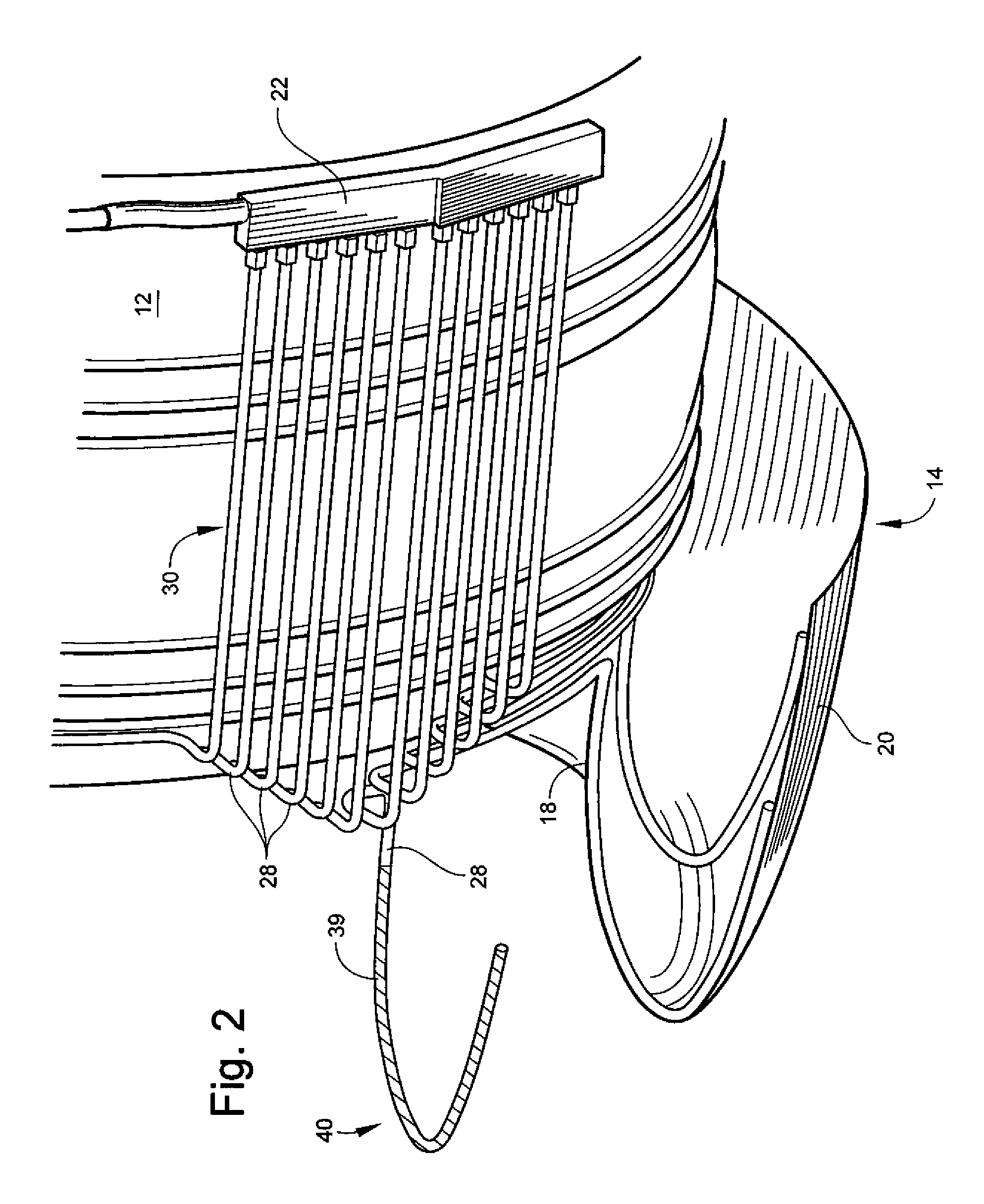 Heat transfer system and method for turbine engine using heat pipes