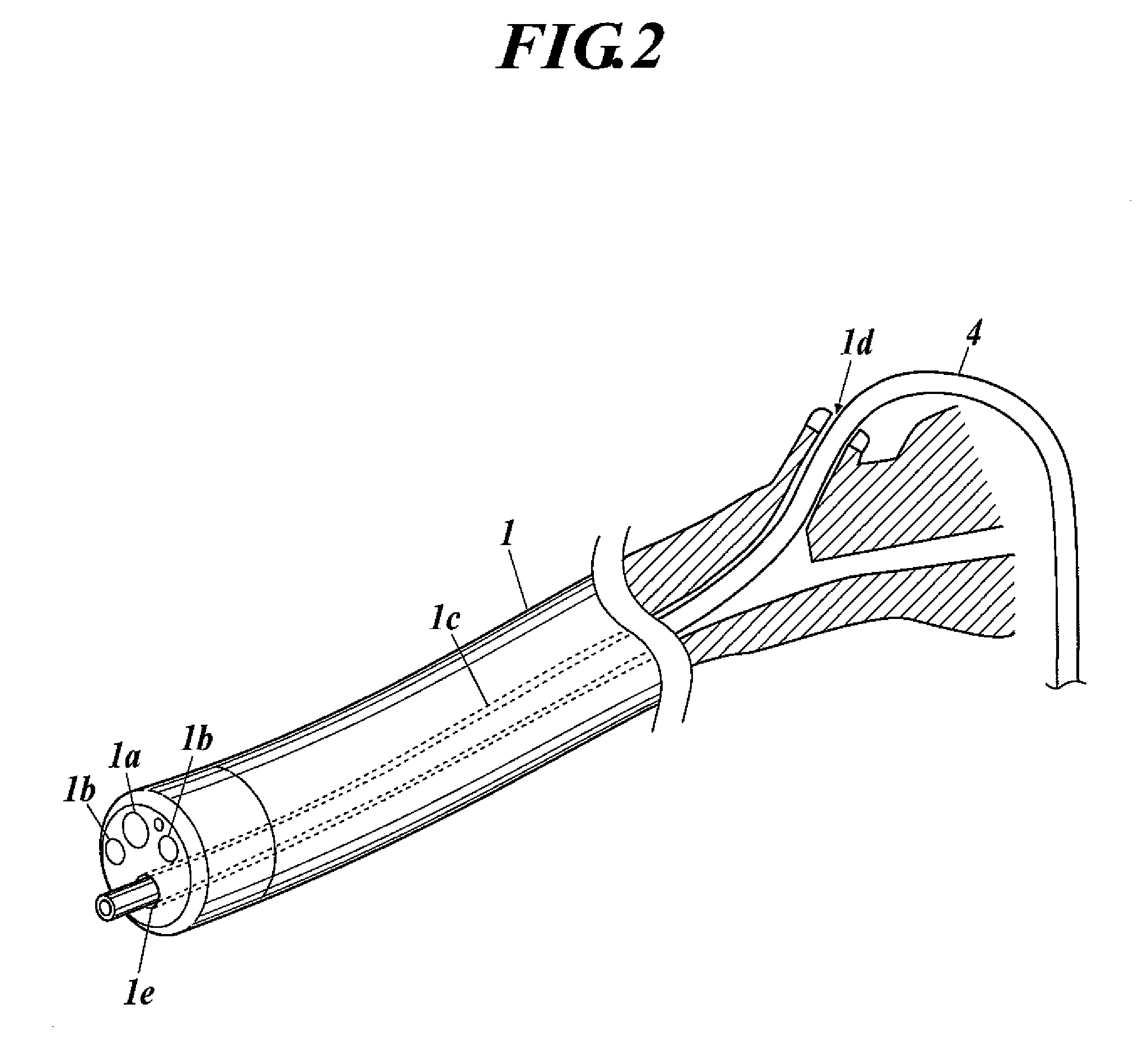 Probe, Diagnosis Device, and Method for Using the Diagnosis Device