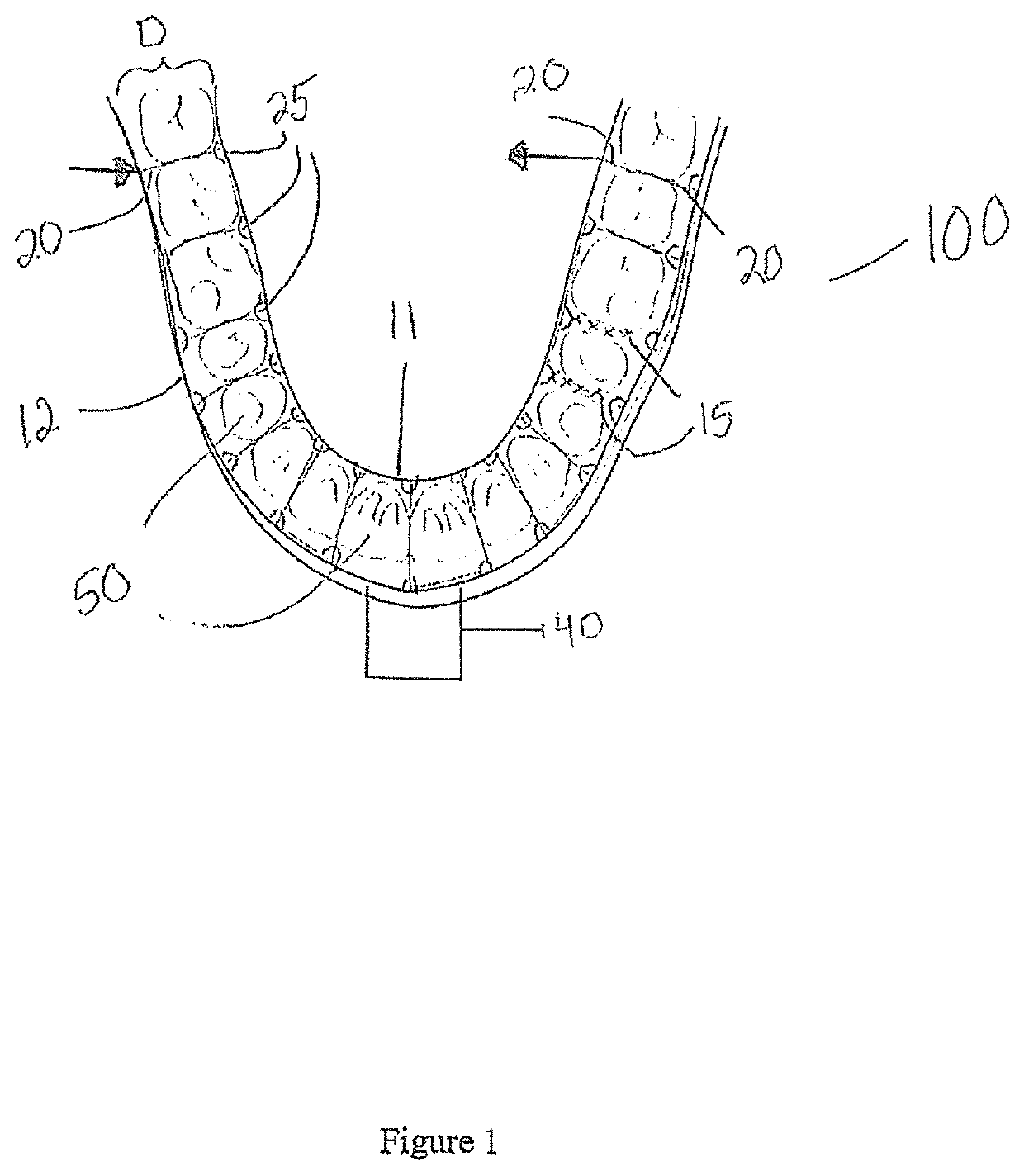 Interdental cleansing device