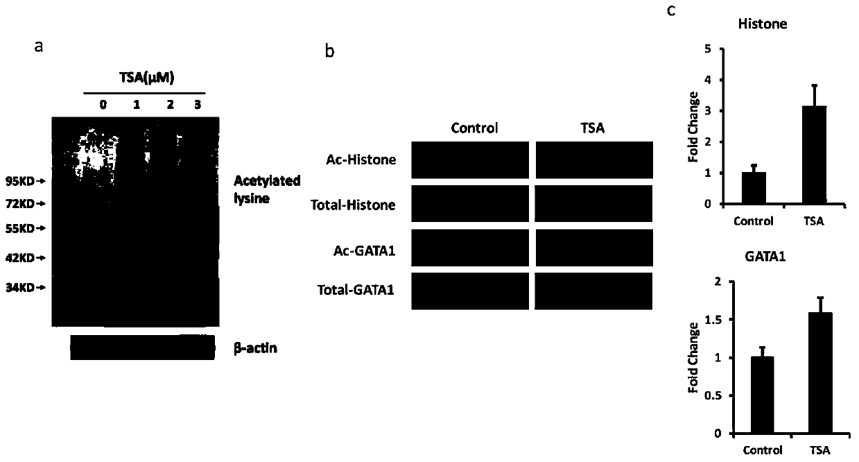 Protein chip and kit for detecting protein acetylation level