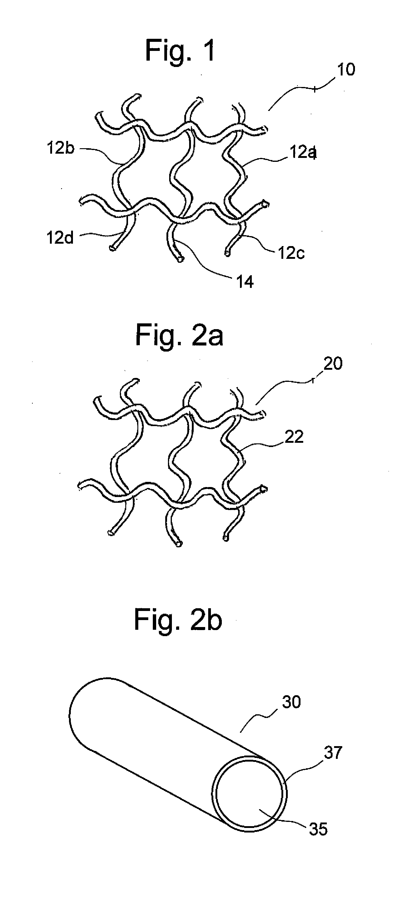 Conductive and degradable implant for pelvic tissue treatment