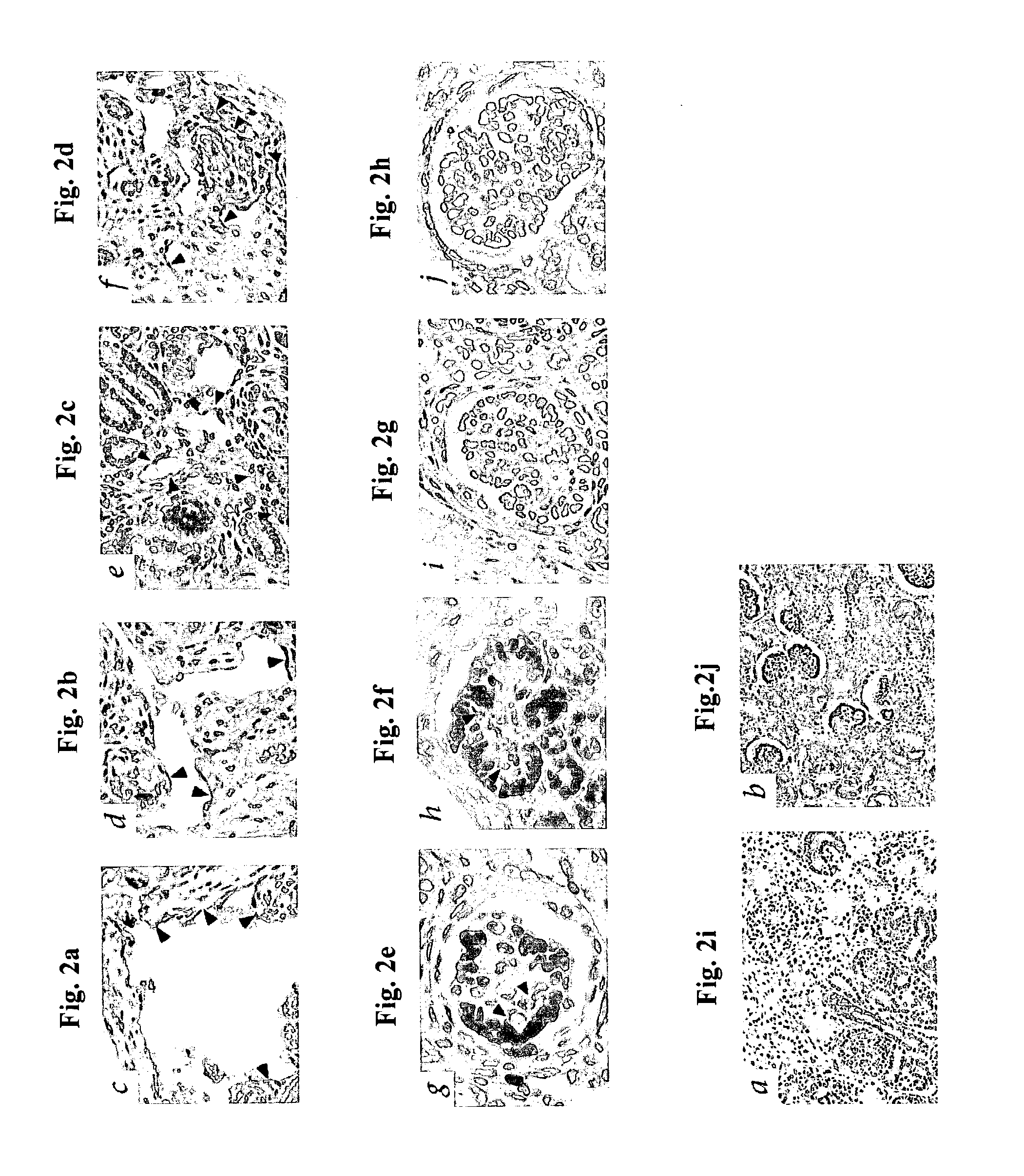 Methods of treating disease by transplantation of developing allogeneic or xenogeneic organs or tissues
