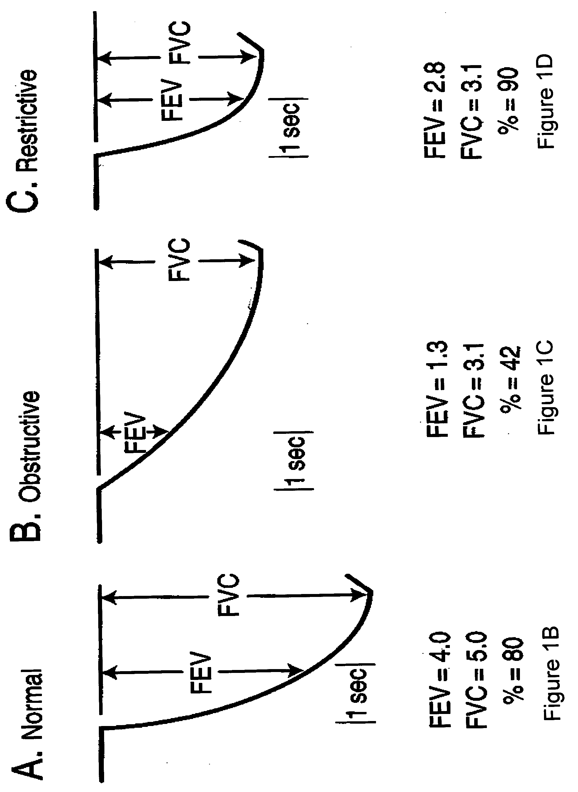 Methods and systems for assessing pulmonary disease