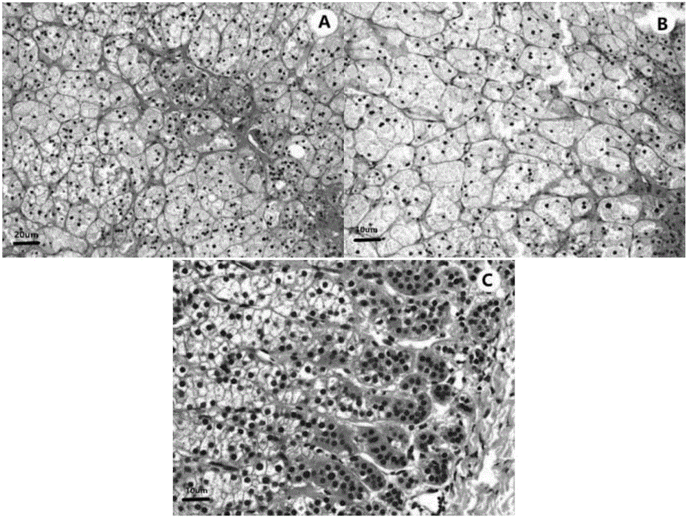 Aldosterone-producing adenoma related up-regulation lncRNA and applications thereof