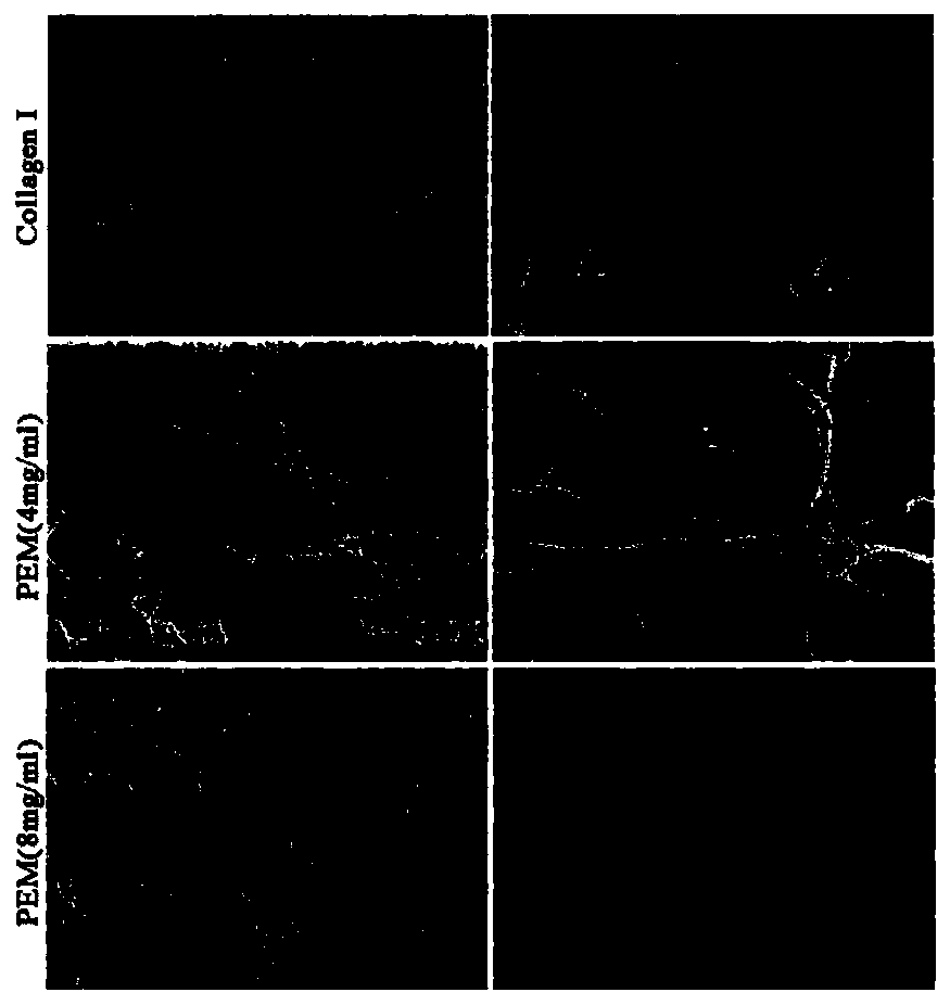 Preparation method for decellularized periosteal matrix gel material sourced from natural tissue