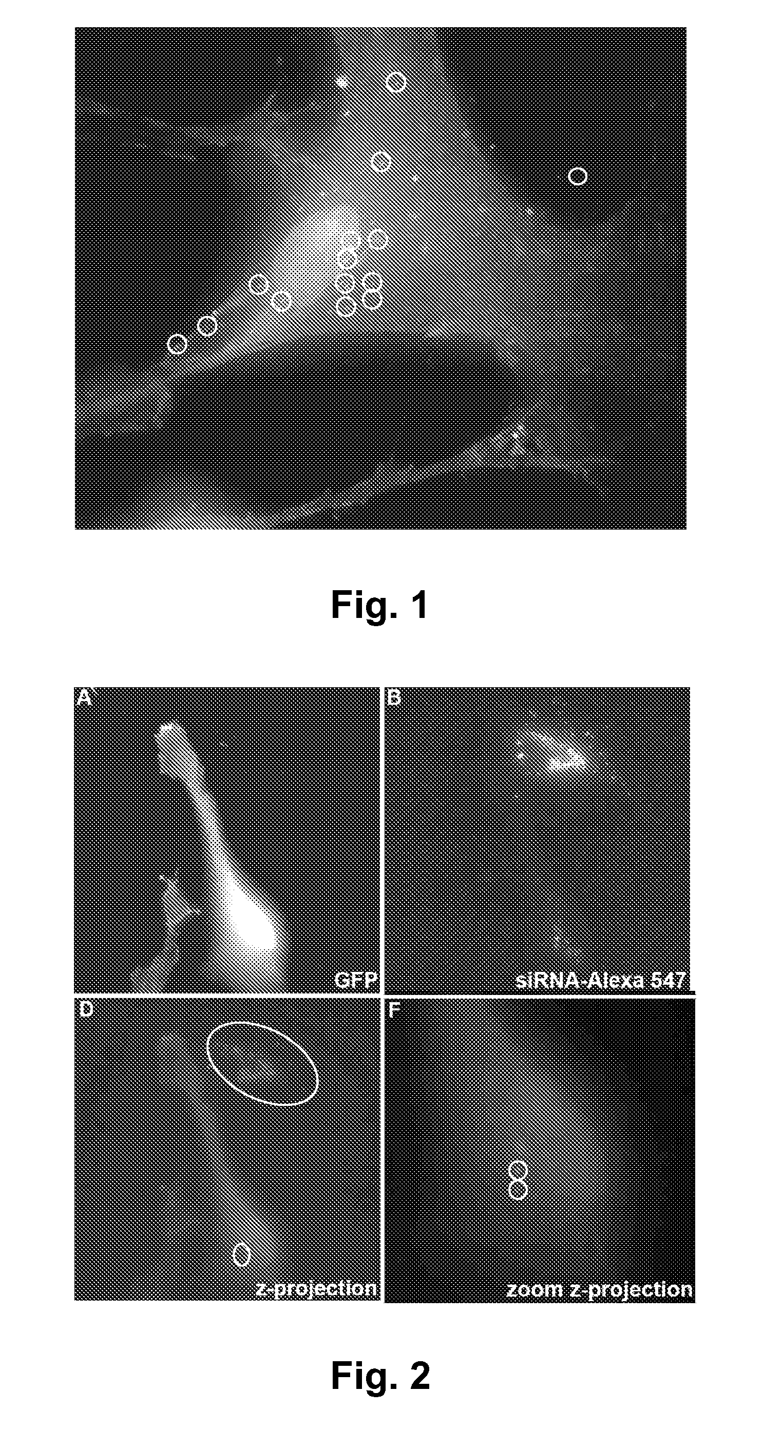 Mesenchymal Stem Cells Producing Inhibitory RNA for Disease Modification