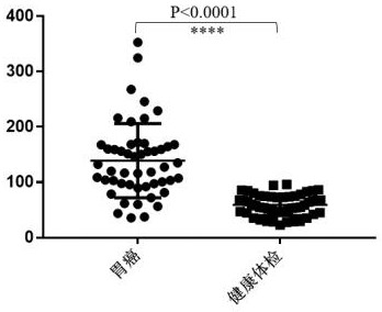 Application of cysteine protease inhibitor SN and Cathepsin L1 compound as gastric cancer diagnosis marker