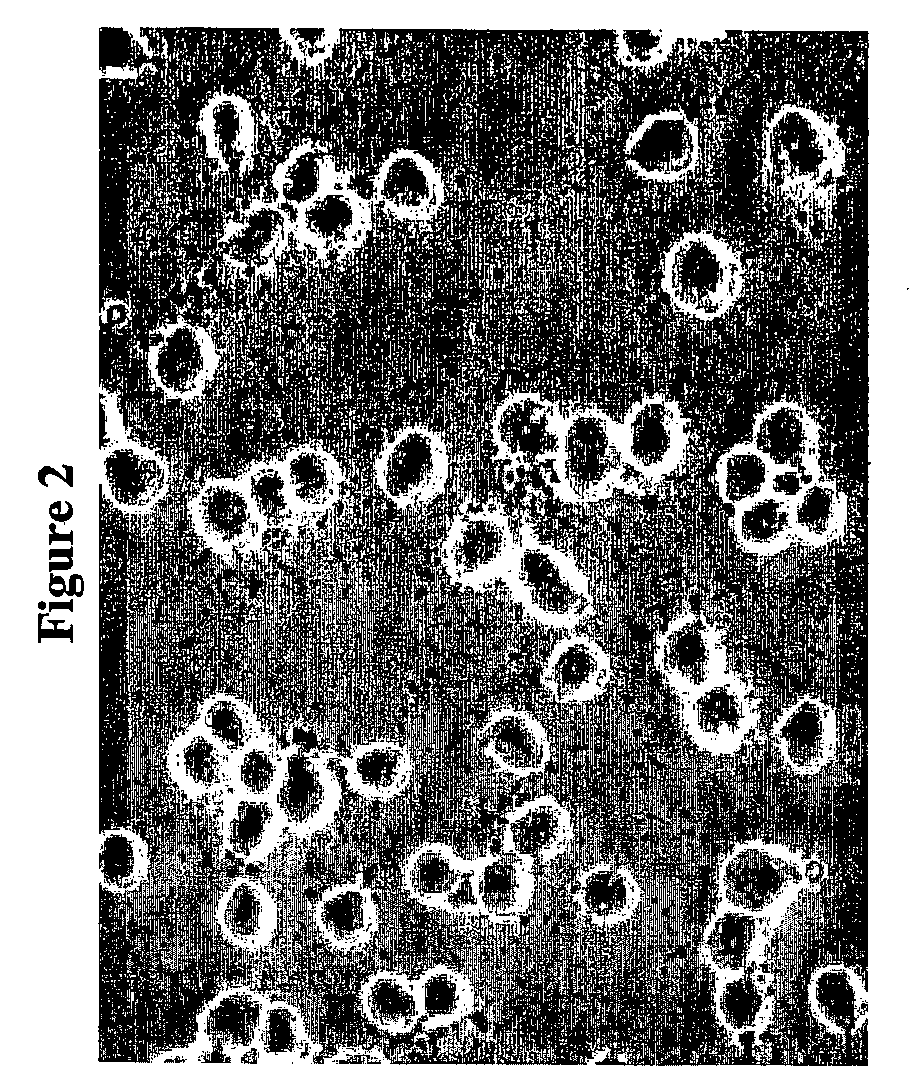 Oligodendrocyte precursor cells and method of obtaining and culturing the same