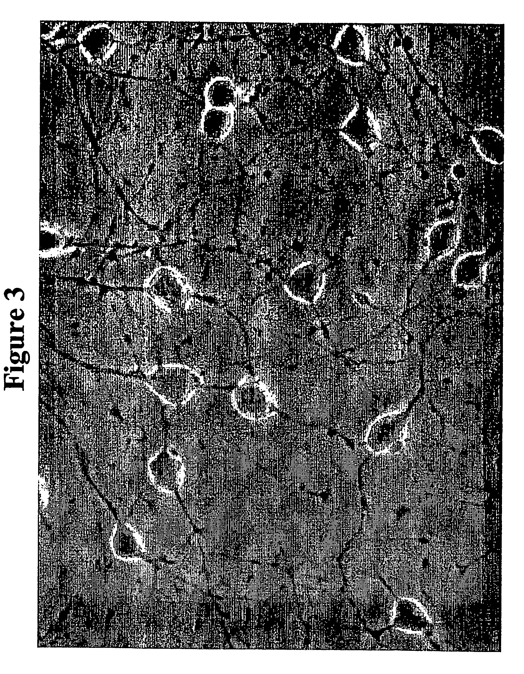 Oligodendrocyte precursor cells and method of obtaining and culturing the same