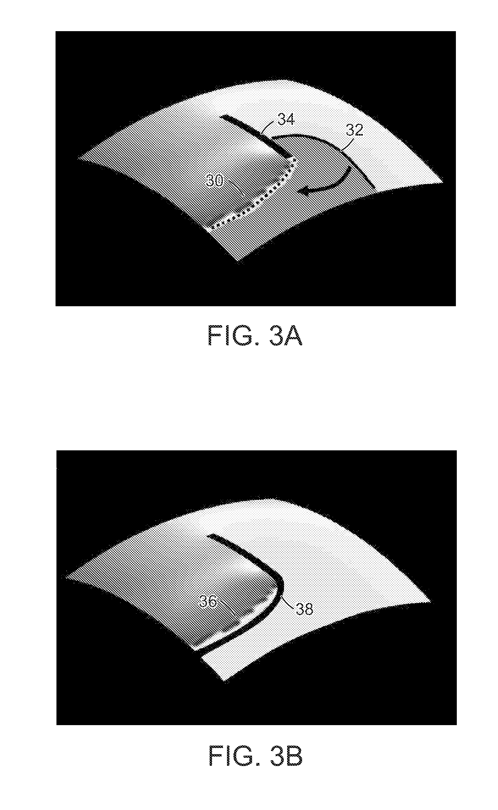 Catheter systems and related methods for mapping, minimizing, and treating cardiac fibrillation