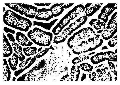 Method for sheeting peanut root tip cell chromosome in mitosis metaphase