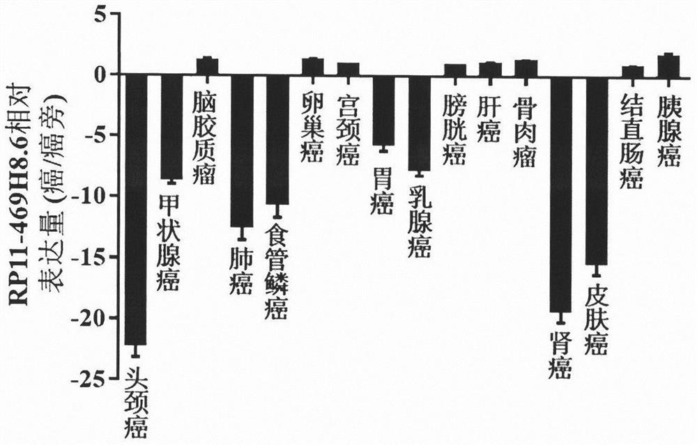 Long-chain non-coding RNA RP11-469H8.6 and application thereof