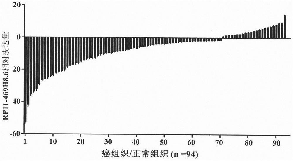 Long-chain non-coding RNA RP11-469H8.6 and application thereof