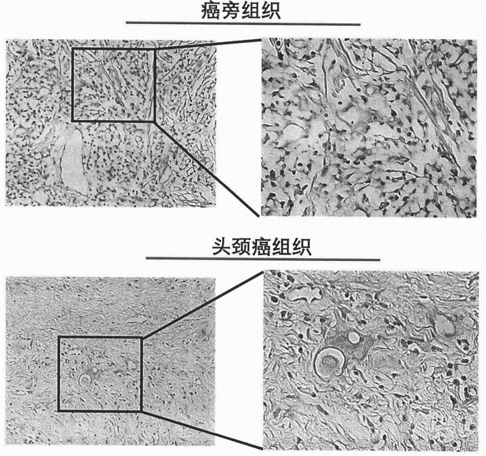 Long-chain non-coding RNA RP11-469H8.6 and application thereof