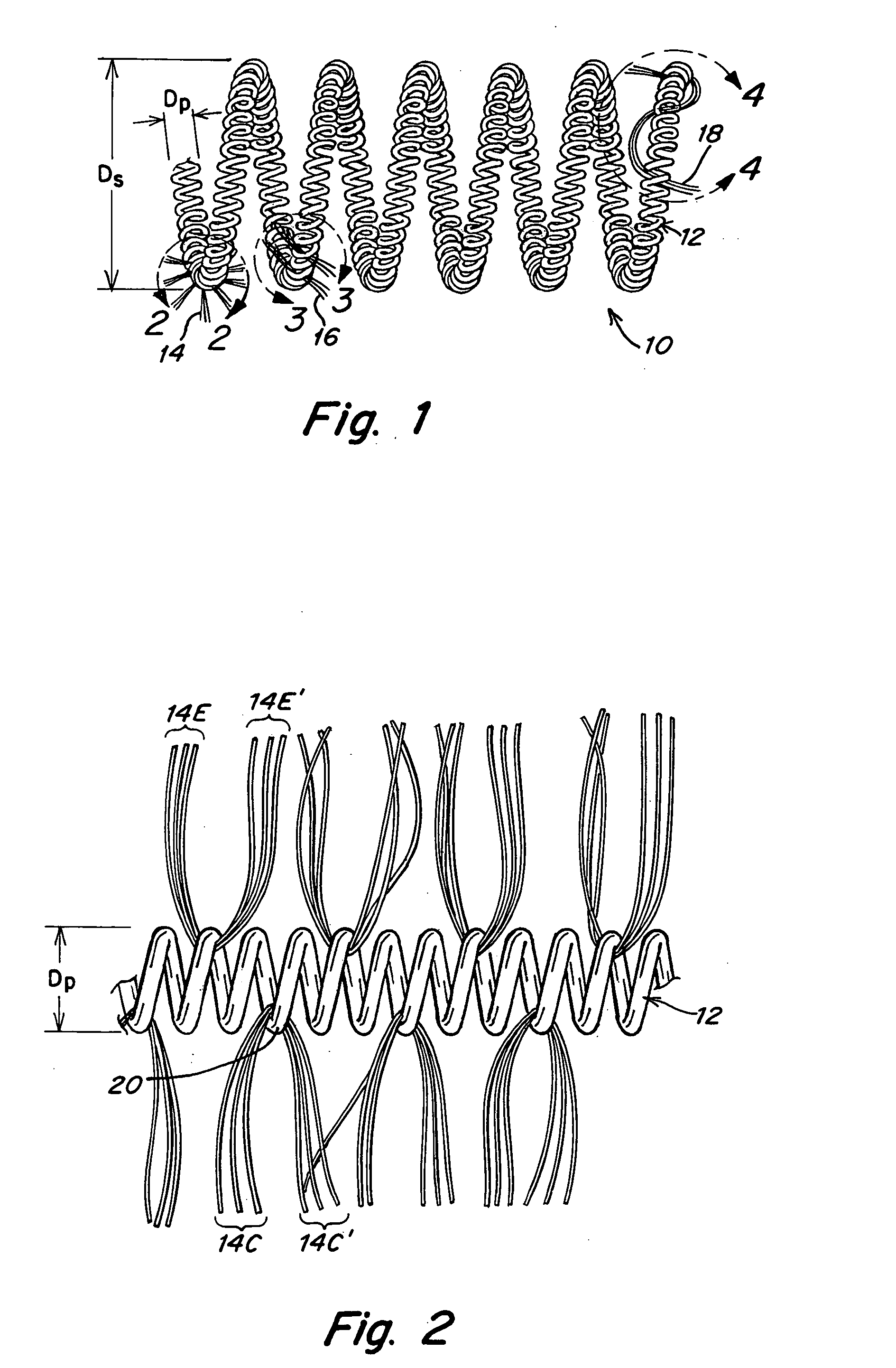 Metallic coils enlaced with biological or biodegradable or synthetic polymers or fibers for embolization of a body cavity