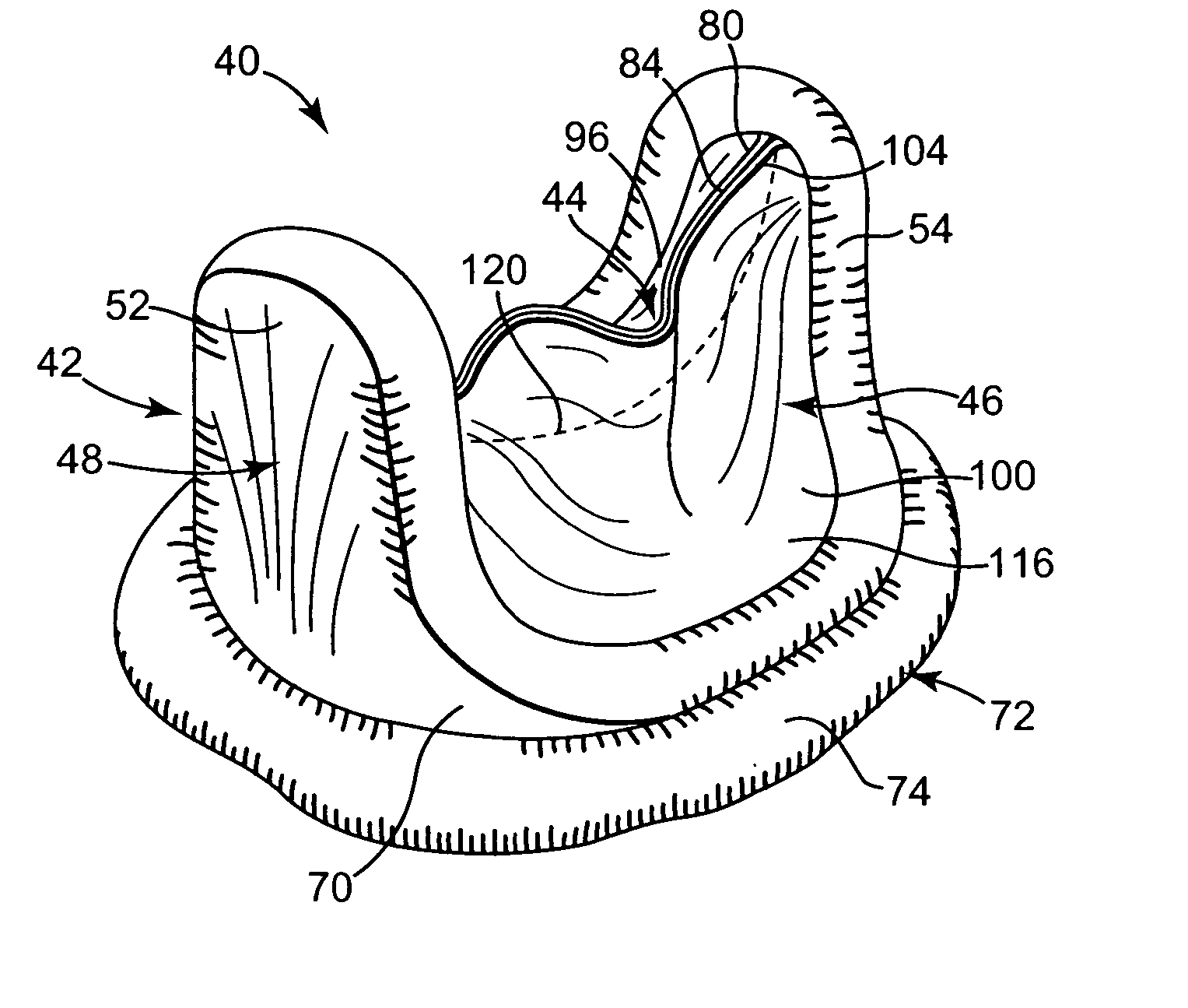 Bileaflet prosthetic valve and method of manufacture