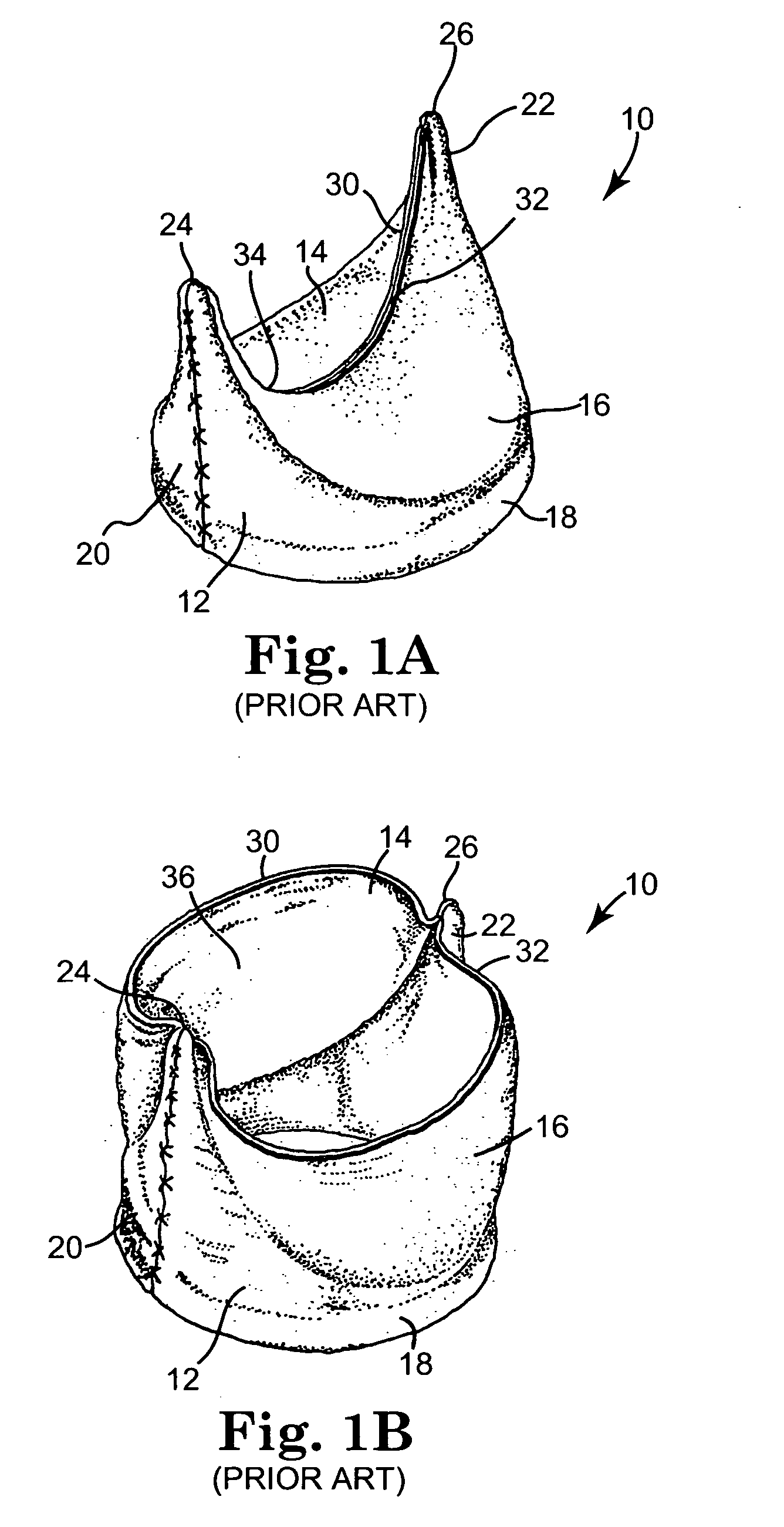 Bileaflet prosthetic valve and method of manufacture