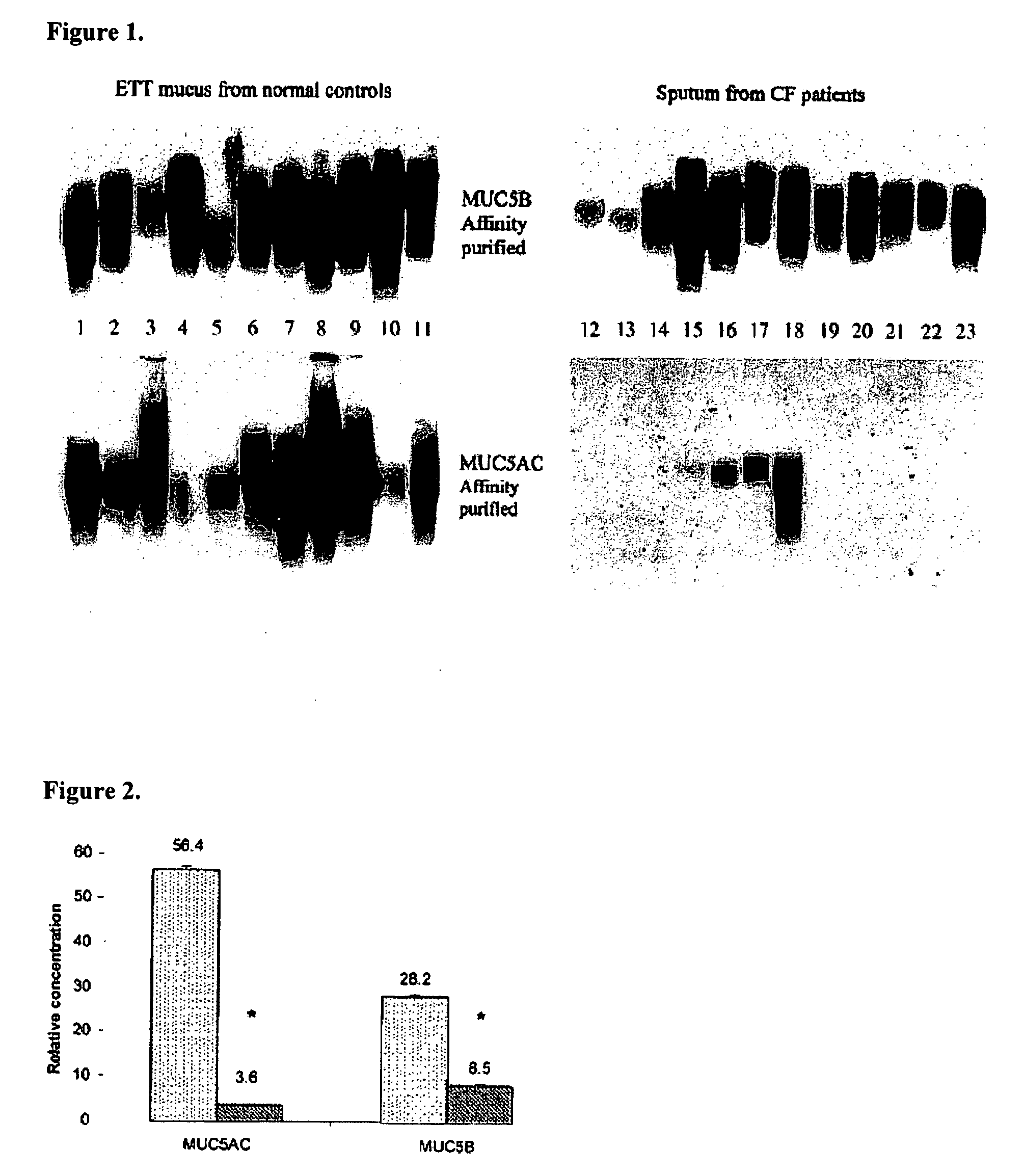 Methods for the treatment of infectious and inflammatory airway diseases