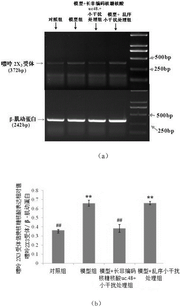 Application of long non-coding RNA uc.48+ small interfering RNA to preparation of medicine for treating DM complicating neuropathic pain