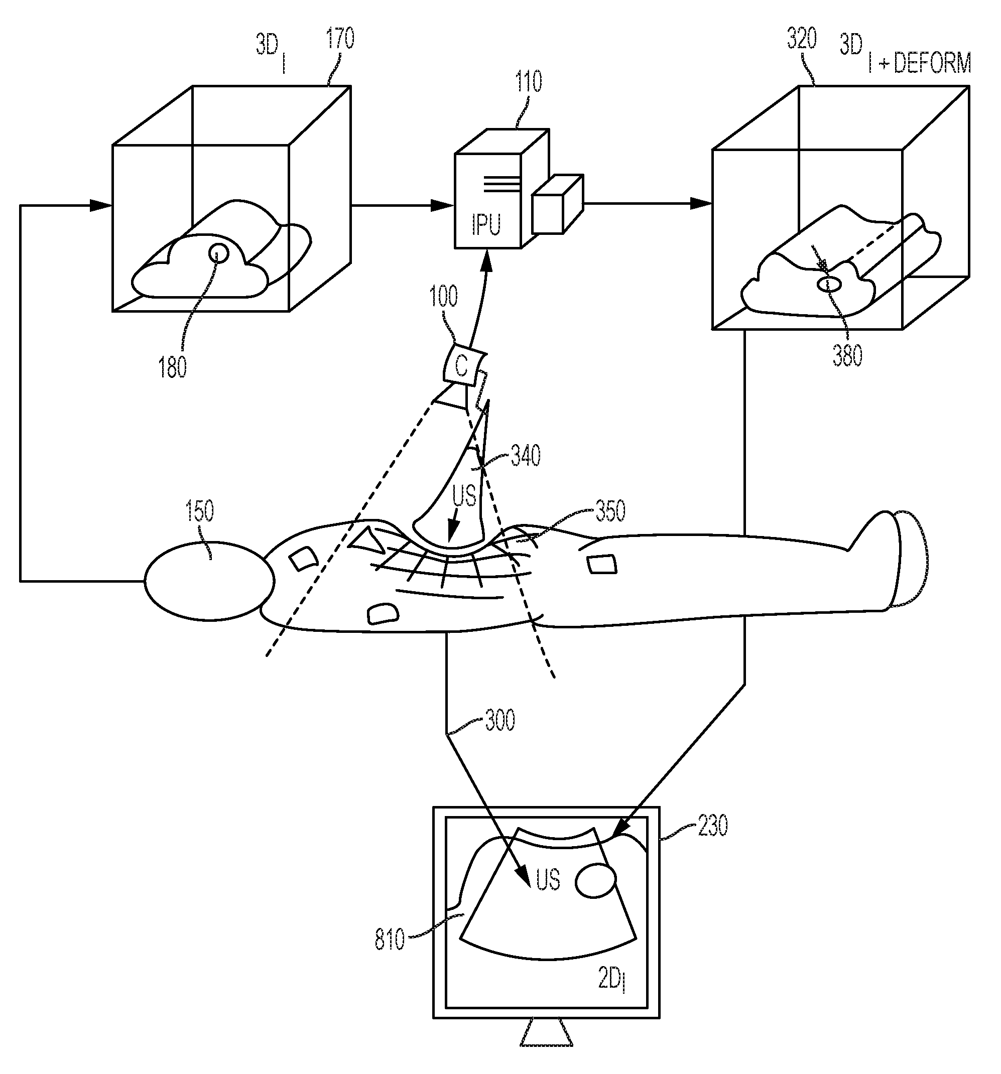 System and method for fused image based navigation with late marker placement
