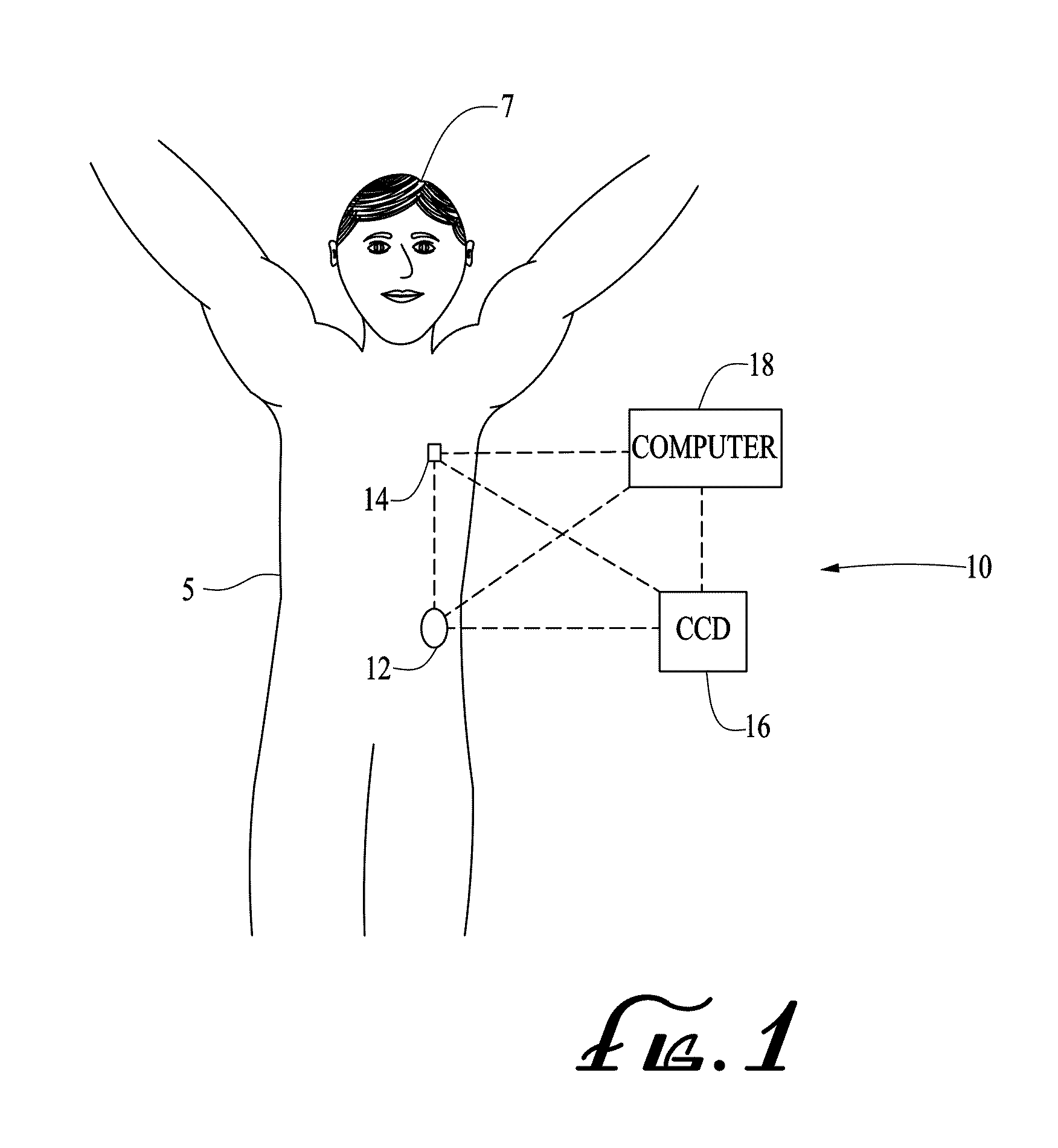 Connection and alignment detection systems and methods
