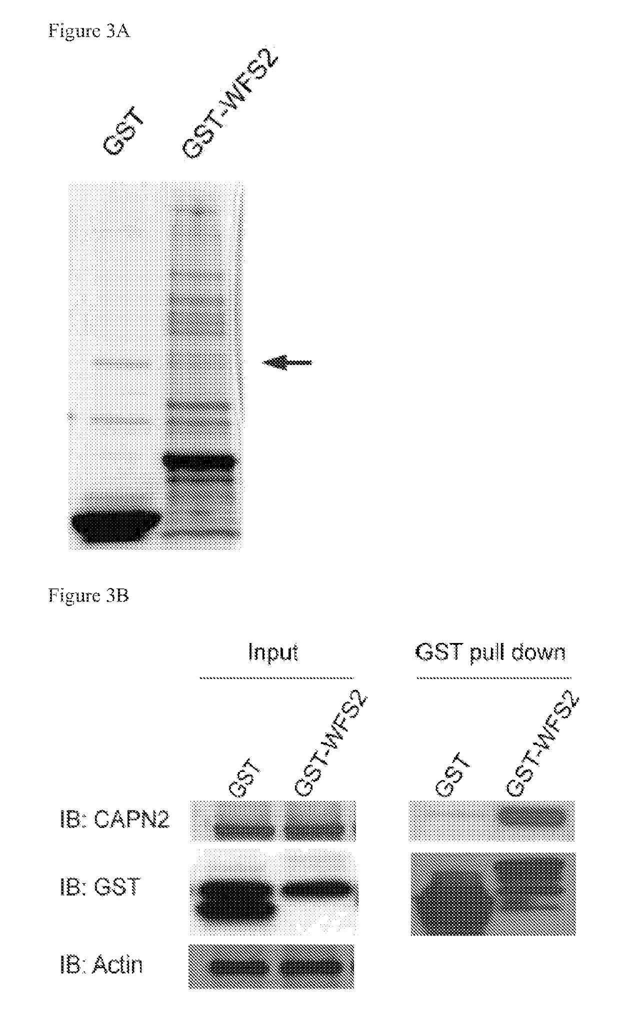 Treatment for wolfram syndrome and other endoplasmic reticulum stress disorders