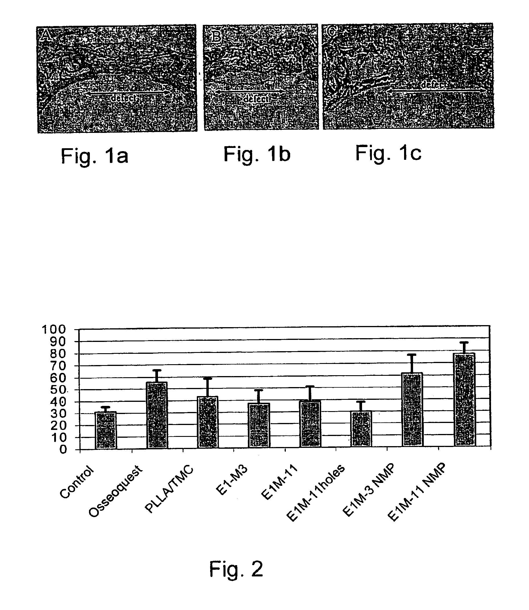 Resorbable polymer composition, implant and method of making implant