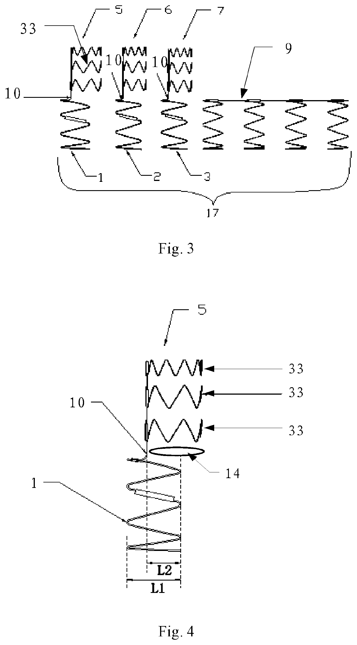 Aortic arch intraoperative stent and manufacturing method thereof