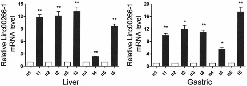 Use of linc00266-1 RNA as a marker for solid tumors