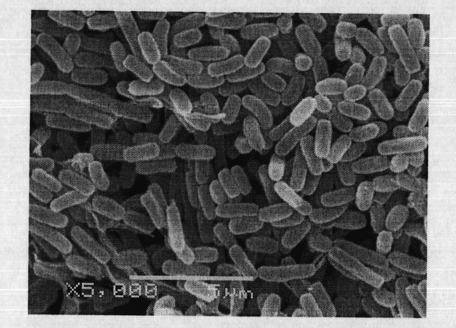 Streptomyces microflavus