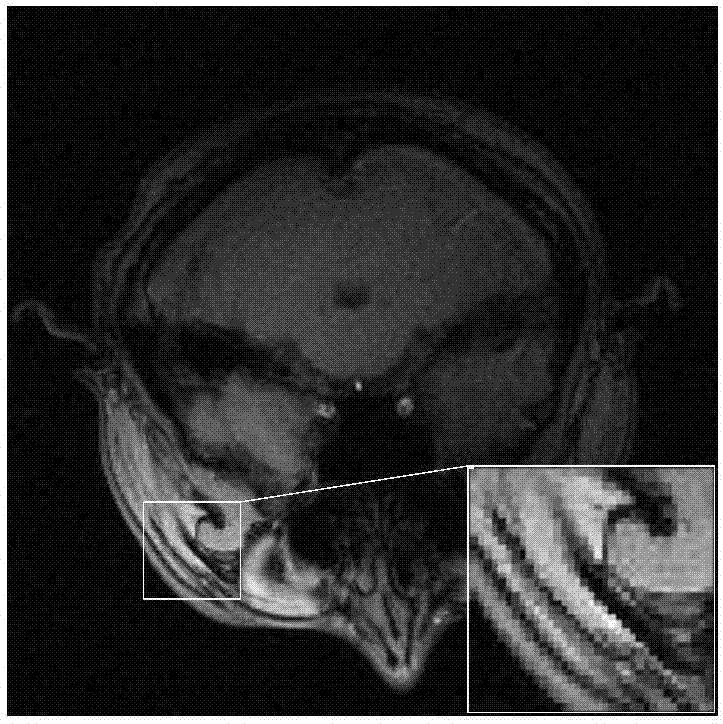 MRI image reconstruction method based on enhanced sparse representation of image blocks