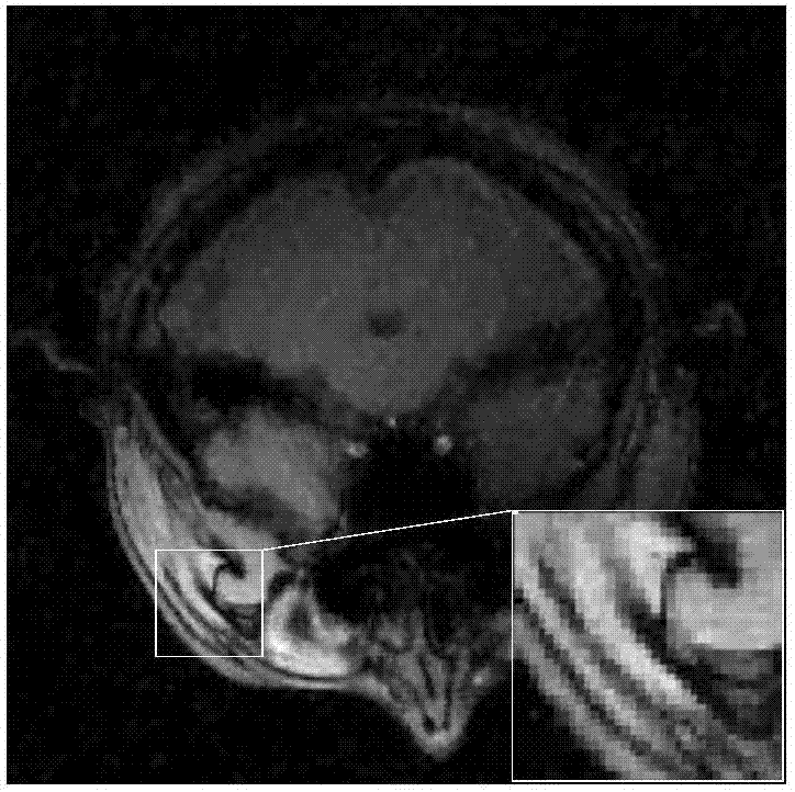 MRI image reconstruction method based on enhanced sparse representation of image blocks