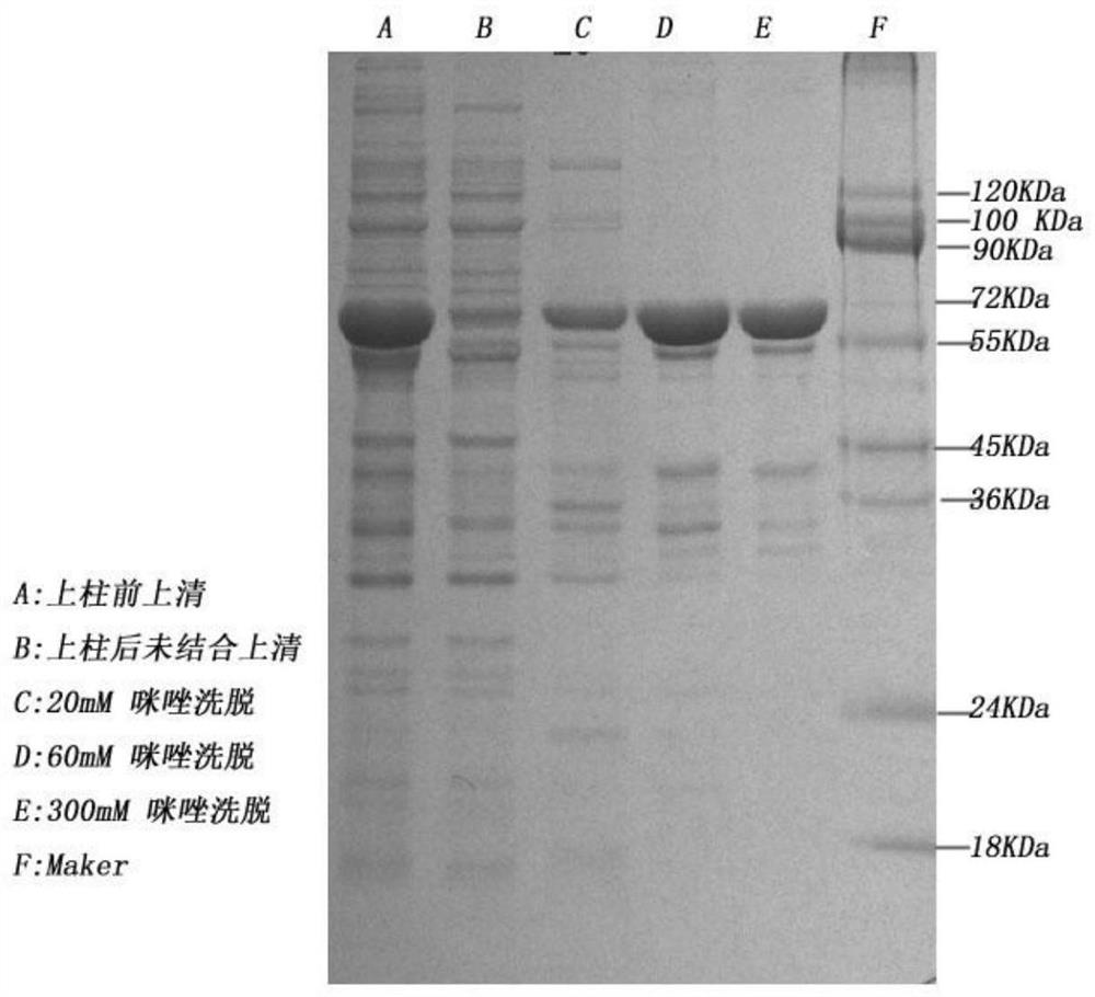 PLA2R, C1q and THSD7A fusion protein and construction method and application thereof