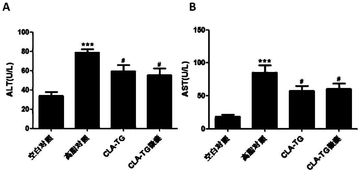 Application of conjugated linoleic acid glyceride in preparing product for treating high fat diet induced non-alcoholic fatty liver diseases