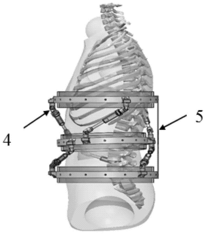 An active spondylosis rehabilitation treatment intelligent orthosis