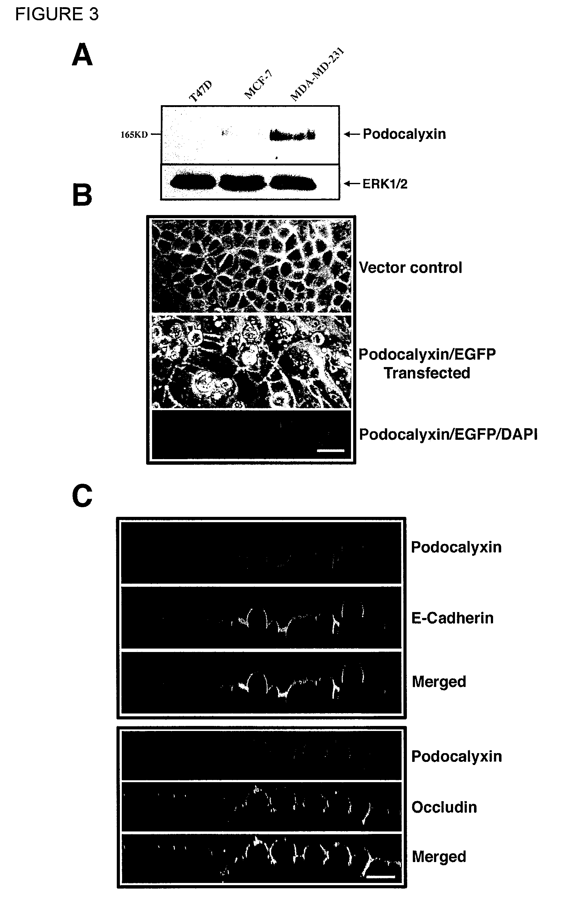 Methods for detecting and treating cancer