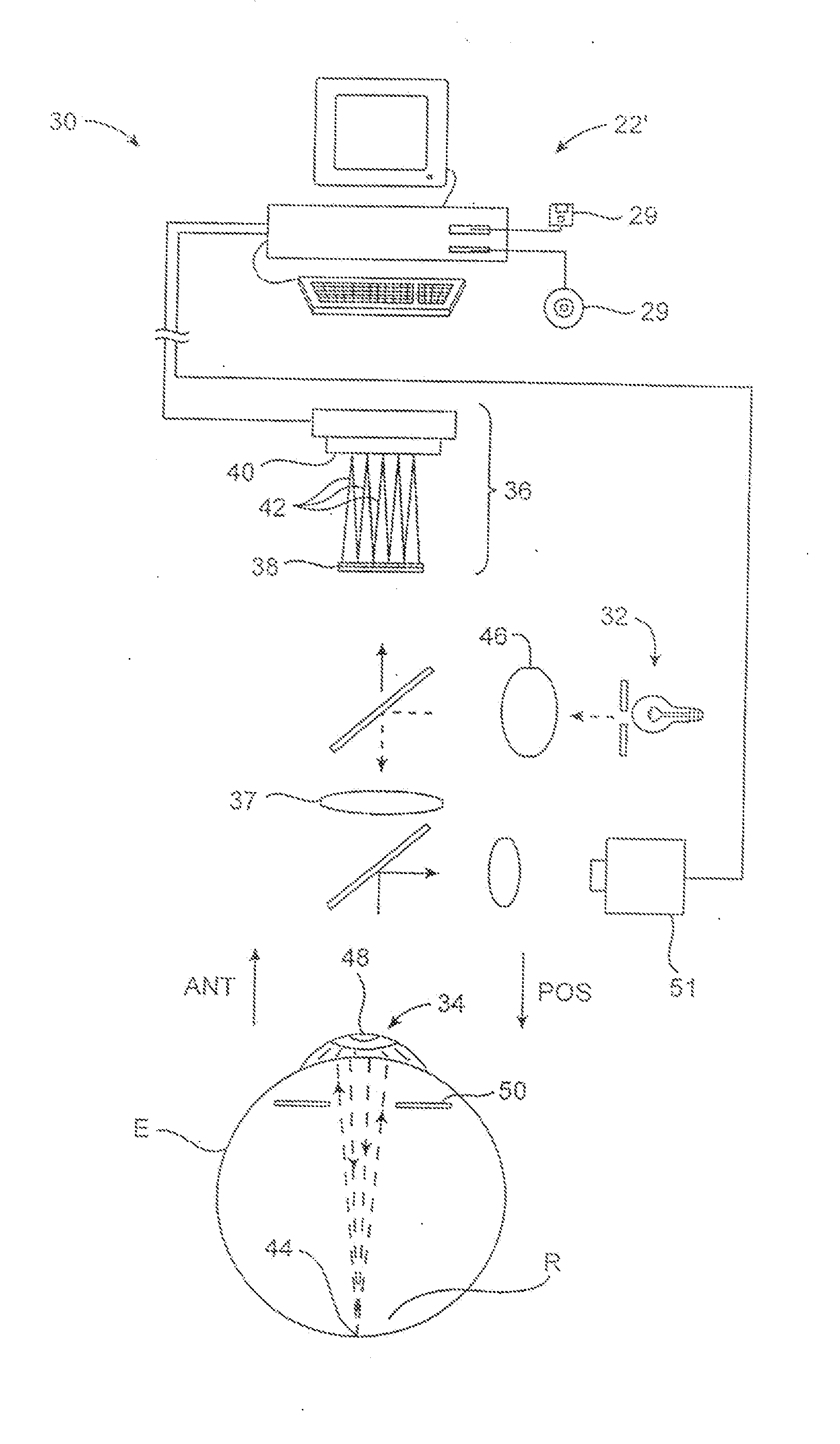 Systems and methods for correcting high order aberrations in laser refractive surgery