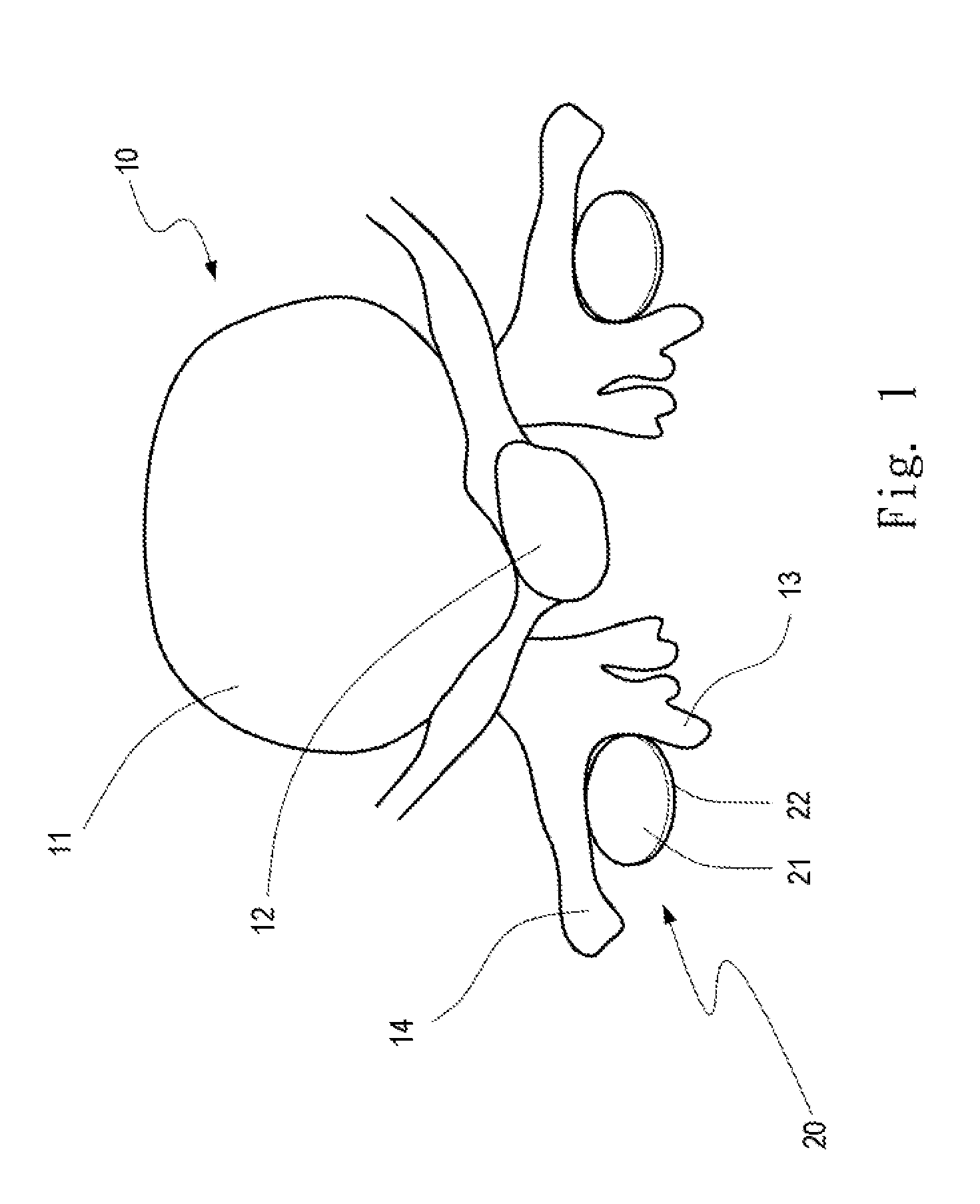 Spinal implant structure and method for manufacturing the same