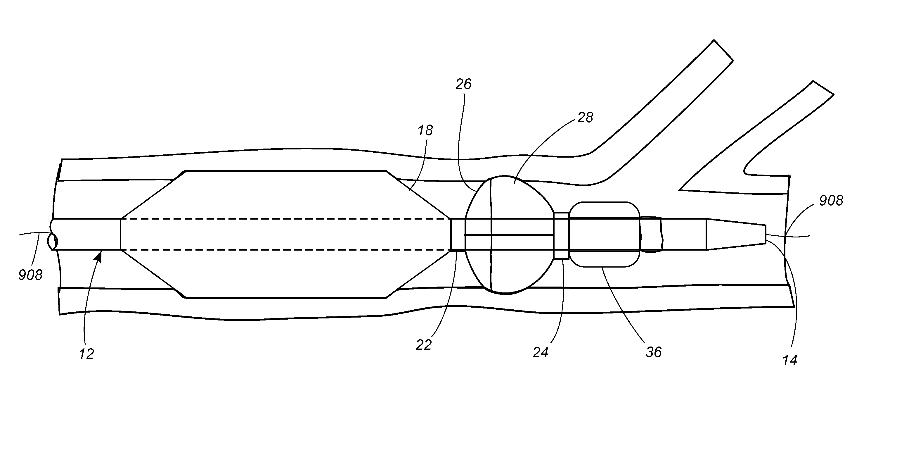 Angioplasty device with embolic filter